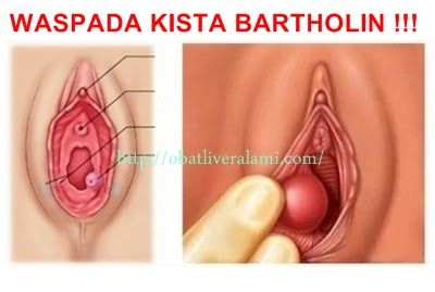 macam bentuk tubuh wanita