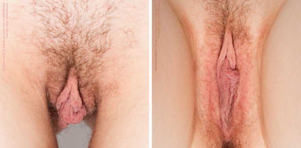 jenis vagina