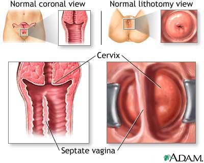 female vagina