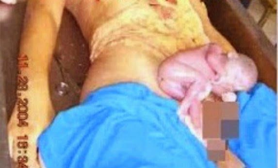 makanan untuk ibu hamil