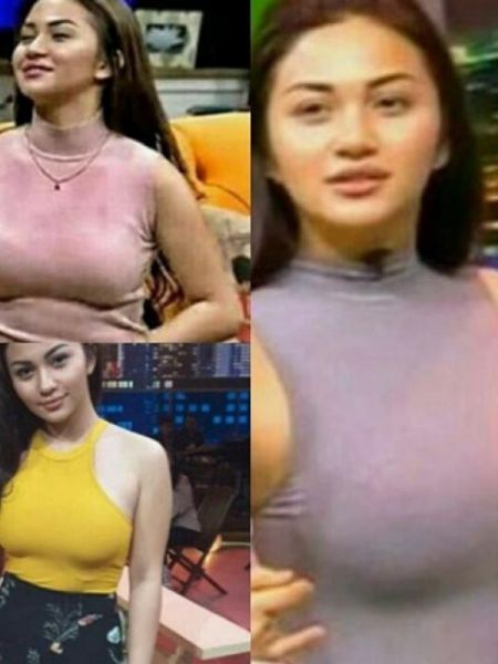 penyakit di puting susu