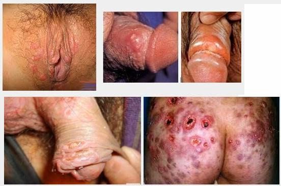 pre vagina