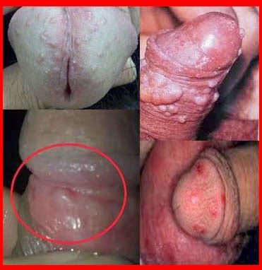 virgin vagina yang
