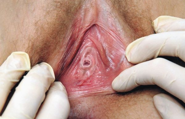 virgin vagina close up