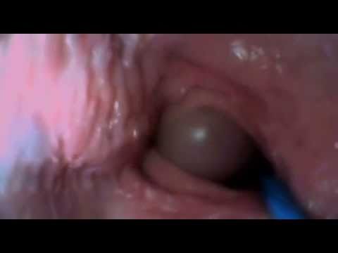 best vagina close up