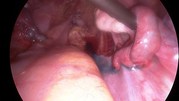 vagina full of cum