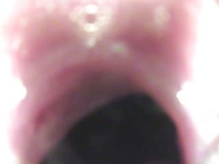 vagina endoscope camera