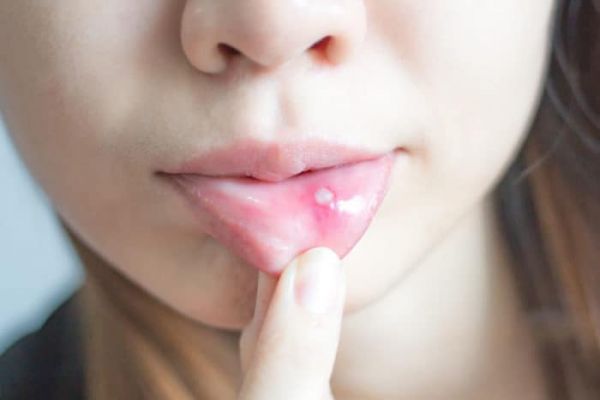 gambar jenis kelamin perempuan