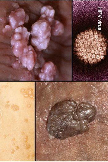 jenis vagina