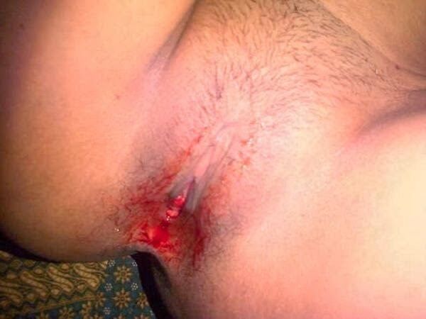 memek tembem