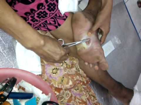 gambar kontol indonesia