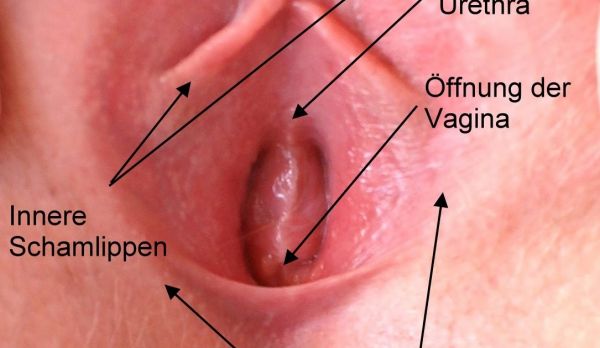 bentuk vagina perawan