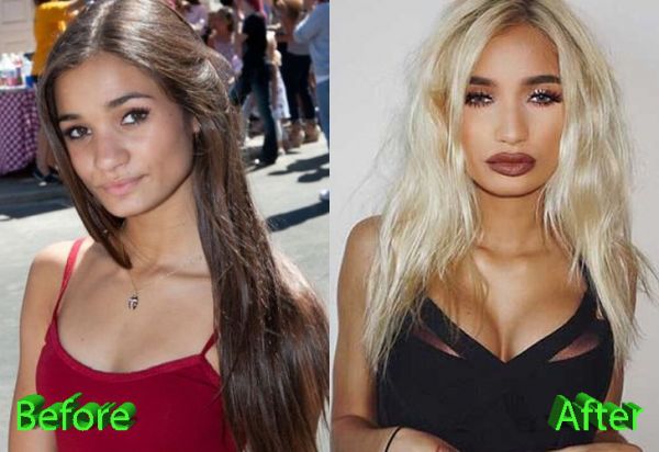 mia khilafah before boob job