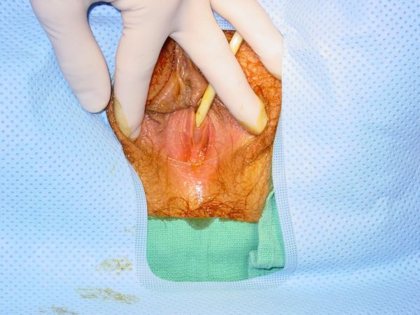inside of a healthy vagina