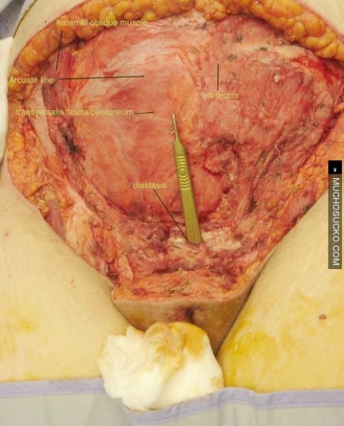 inside a vigina
