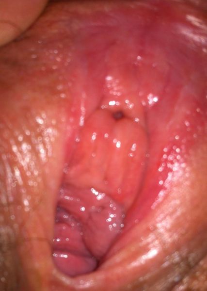 healthy looking vagina