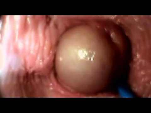 healthy vagina