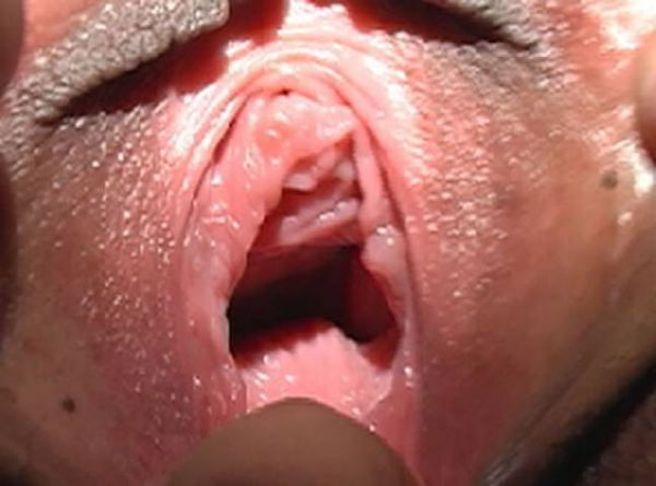 world record smallest vagina
