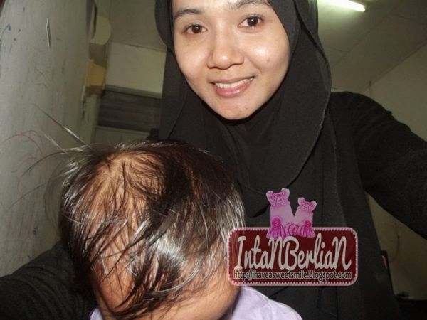 gambar tempek
