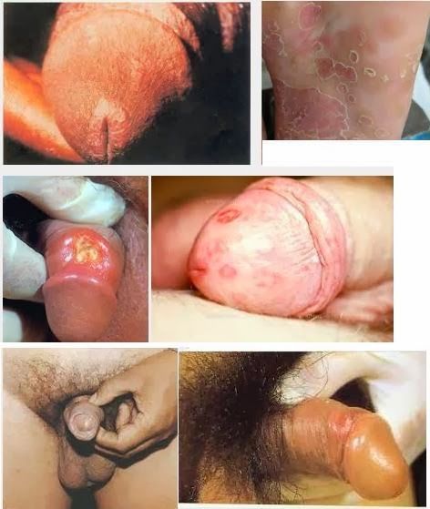 female vagina and penis
