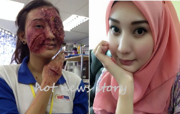 kemaluan wanita