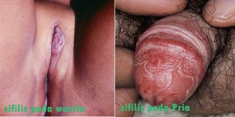 memek basah abg