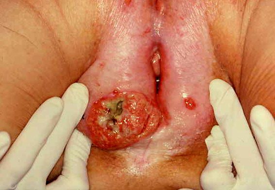 female vagina