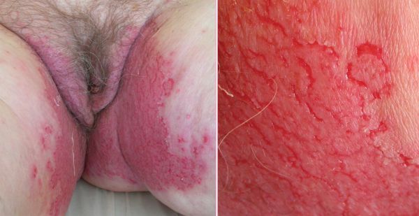 inside vagina