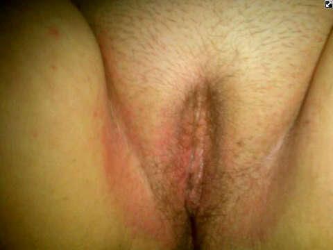memek terbesar di dunia