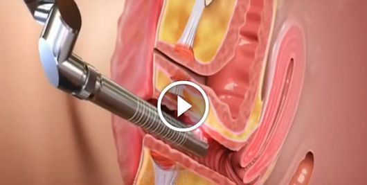 vagina anatomy