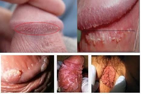 gambar perawan