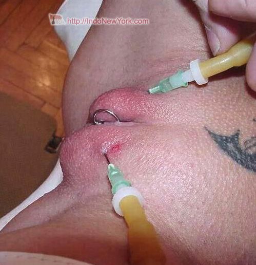 girls vagina