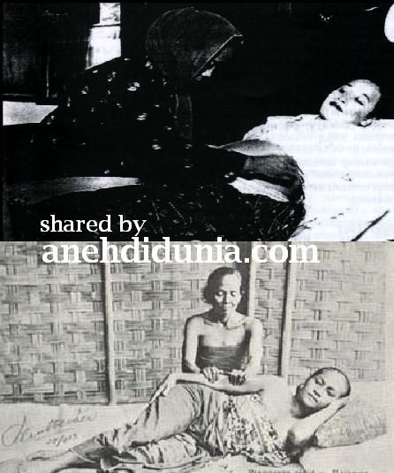 gambar orang melahirkan