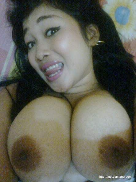 penyakit di puting susu