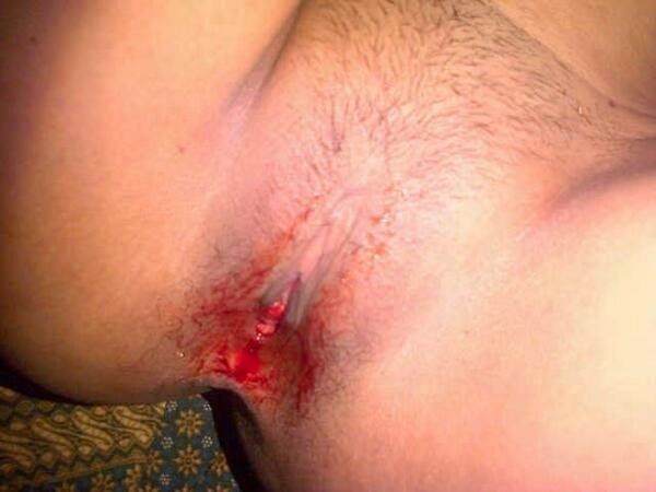 itil memek