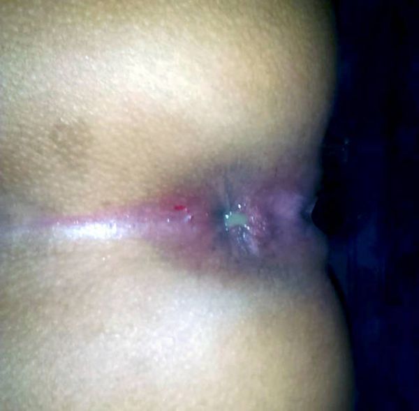 memek di entot kontol jumbo