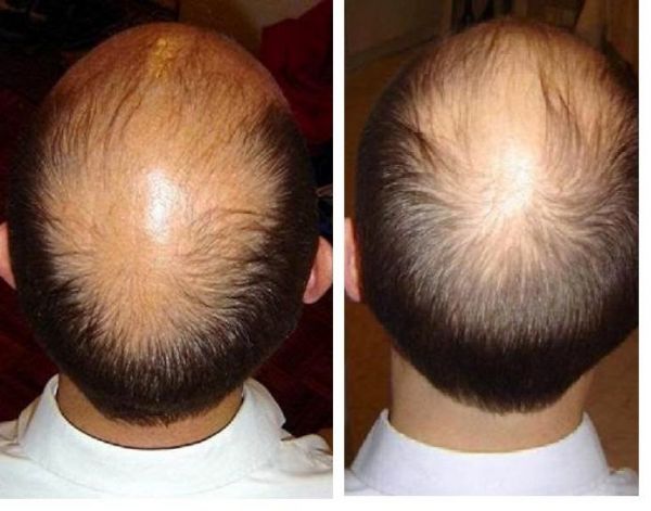 rambut bunga citra lestari