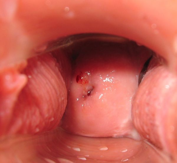 into her vagina