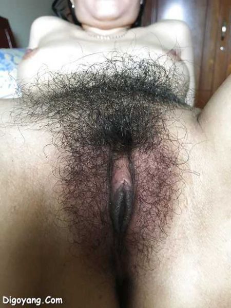 abg igo