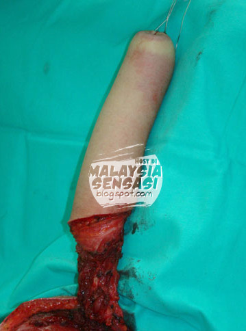 gambar kelamin pria