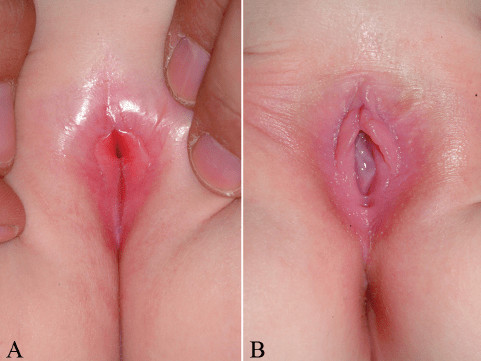 normal vbg results