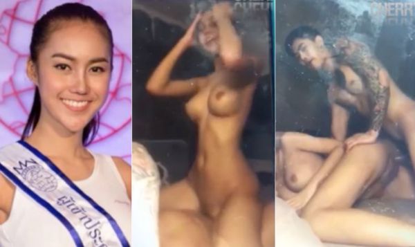 sakinya tuh disini