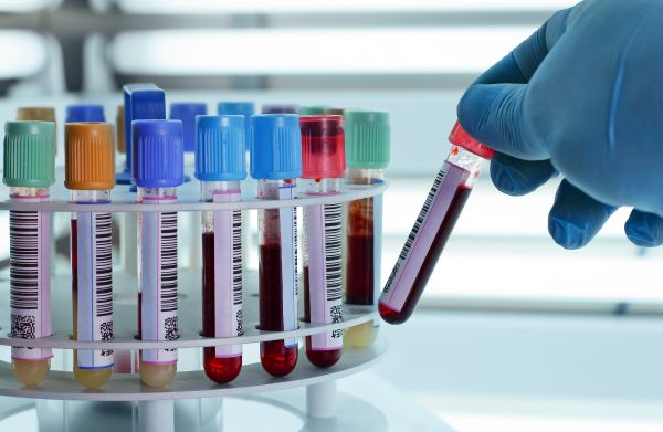 clot catcher for arterial blood gas syringe