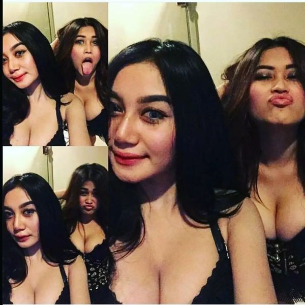 gigi artis indonesia